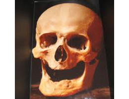 Don’t lose your Head: Haydn’s Skull