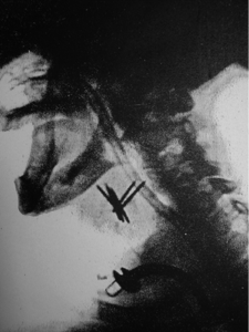 X-ray of Puccini