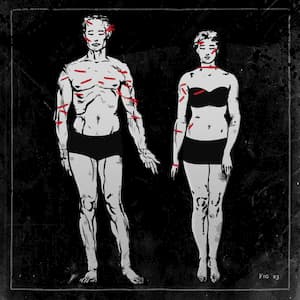 Wounds of Don Fabrizio Carafa and Donna Maria d’Avalos from The Gesualdo murders
