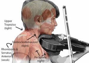 violin anatomy